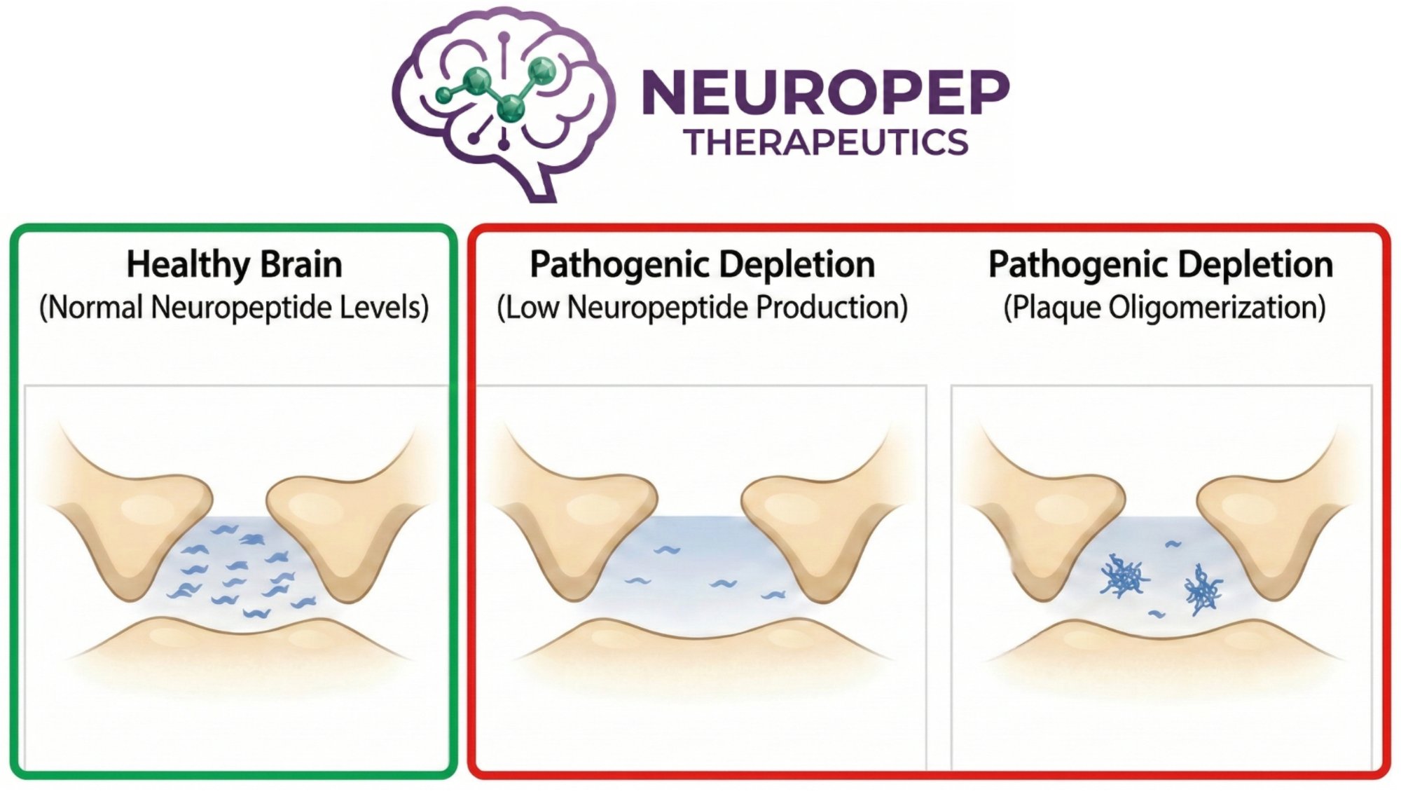 The Depletion Model of Alzheimer's Disease